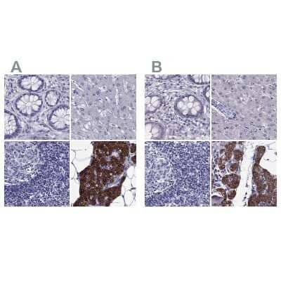 Immunohistochemistry-Paraffin: AAK1 Antibody [NBP1-84110] - Staining of human colon, liver, lymph node and parathyroid gland using Anti-AAK1 antibody NBP1-84110 (A) shows similar protein distribution across tissues to independent antibody NBP1-84111 (B).