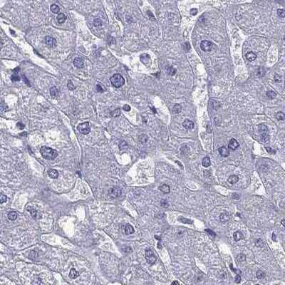 Immunohistochemistry-Paraffin: AAK1 Antibody [NBP1-84110] - Staining of human liver.