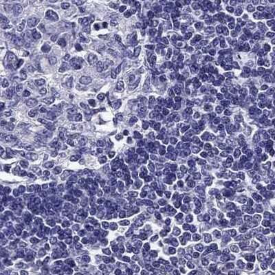 Immunohistochemistry-Paraffin: AAK1 Antibody [NBP1-84110] - Staining of human lymph node.