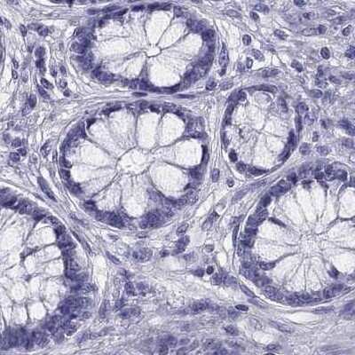 Immunohistochemistry-Paraffin: AAK1 Antibody [NBP1-84110] - Staining of human colon.