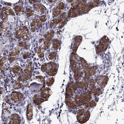 Immunohistochemistry-Paraffin: AAK1 Antibody [NBP1-84111] - Staining of human parathyroid gland shows high expression.