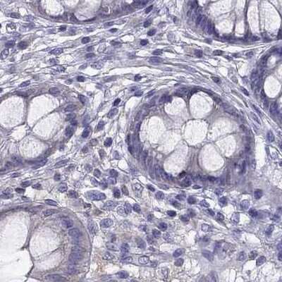 Immunohistochemistry-Paraffin: AAK1 Antibody [NBP1-84111] - Staining of human colon.