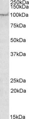 Western Blot: AAK1 Antibody [NBP1-45214] - (1ug/ml) Analysis of Human Amygdala lysate (35ug protein in RIPA buffer). Primary incubation was 1 hour. Detected by chemiluminescence.