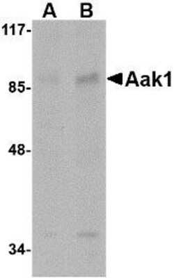 Western Blot: AAK1 Antibody [NBP1-76343] - A-20 lysate with Aak1 antibody at (A) 1 and (B) 2 ug/ml.