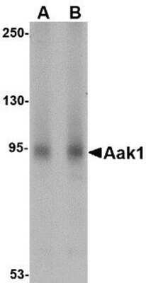 Western Blot: AAK1 Antibody [NBP1-77335] - A-20 lysate with Aak1 antibody at (A) 1 and (B) 2 ug/ml.