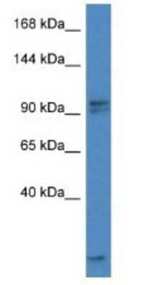 Western Blot: AAK1 Antibody [NBP1-79574] - Mouse Thymus Lysate 1ug/ml  Gel Concentration 6-18%