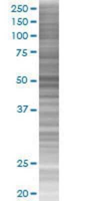 Western Blot: AAK1 Overexpression Lysate [H00022848-T01] - AAK1 transfected lysate.