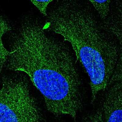 Immunocytochemistry/Immunofluorescence: AAMP Antibody [NBP2-58072] - Staining of human cell line U-2 OS shows localization to cytosol & microtubules.