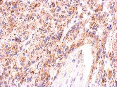 Immunohistochemistry-Paraffin: AAMP Antibody [NBP2-21597] - Immunohistochemical analysis of paraffin-embedded U373 xenograft, using antibody at 1:500 dilution.