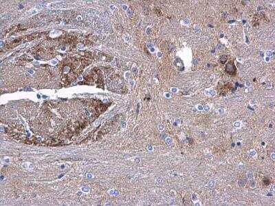 Immunohistochemistry-Paraffin: AAMP Antibody [NBP2-21597] - AAMP antibody detects AAMP protein at cytoplasm in mouse middle brain by immunohistochemical analysis. Sample: Paraffin-embedded mouse middle brain. AAMP antibody diluted at 1:500. Antigen Retrieval: Citrate buffer, pH 6.0, 15 min.