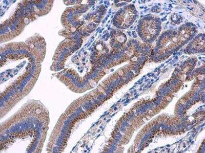Immunohistochemistry-Paraffin: AAMP Antibody [NBP2-21597] - AAMP antibody detects AAMP protein at cytoplasm in mouse duodenum by immunohistochemical analysis. Sample: Paraffin-embedded mouse duodenum. AAMP antibody diluted at 1:500. Antigen Retrieval: Citrate buffer, pH 6.0, 15 min.