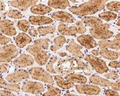Immunohistochemistry-Paraffin: AAMP Antibody [NBP3-12703] - Staining of human AAMP in human kidney with rabbit polyclonal antibody at 1:100 dilution. 