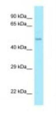 Western Blot: AAMP Antibody [NBP1-98514] - MCF7 Cell Lysate 1.0ug/ml, Gel Concentration: 12%