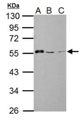 Western Blot: AAMP Antibody [NBP2-21597] - A. 30 ug 293T whole cell lysate/extract B. 30 ug HepG2 whole cell lysate/extract C. 30 ug A375 whole cell lysate/extract 10 % SDS-PAGE AAMP antibody dilution: 1:1000.