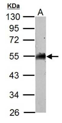 Western Blot: AAMP Antibody [NBP2-21597] - A. 50 ug mosue brain lysate/extract 10 % SDS-PAGE AAMP antibody dilution: 1:1000.