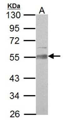 Western Blot AAMP Antibody - BSA Free