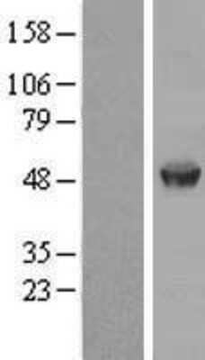 Western Blot: AAMP Overexpression Lysate (Adult Normal) [NBP2-08441] Left-Empty vector transfected control cell lysate (HEK293 cell lysate); Right -Over-expression Lysate for AAMP.