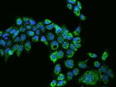 Immunocytochemistry/Immunofluorescence: AARS2 Antibody [NBP2-98582] - Immunofluorescence staining of AARS2 in A431 cells. Cells were fixed with 4% PFA, permeabilzed with 0.1% Triton X-100 in PBS, blocked with 10% serum, and incubated with rabbit anti-Human AARS2 polyclonal antibody (dilution ratio 1:200) at 4C overnight. Then cells were stained with the Alexa Fluor(R)488-conjugated Goat Anti-rabbit IgG Secondary antibody (green) and counterstained with DAPI (blue).Positive staining was localized to Cytoplasm.