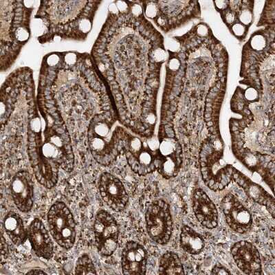 Immunohistochemistry-Paraffin: AARS2 Antibody [NBP1-89323] - Staining of human duodenum shows strong granular cytoplasmic positivity in glandular cells.