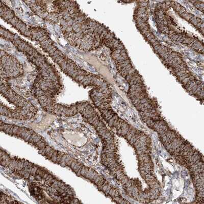 Immunohistochemistry-Paraffin: AARS2 Antibody [NBP1-89323] - Staining of human Fallopian tube shows strong granular cytoplasmic positivity in glandular cells.
