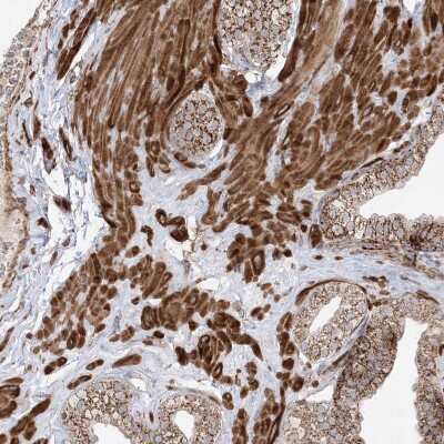 Immunohistochemistry-Paraffin: AARS2 Antibody [NBP1-89323] - Staining of human prostate shows strong cytoplasmic positivity in smooth muscle cells.