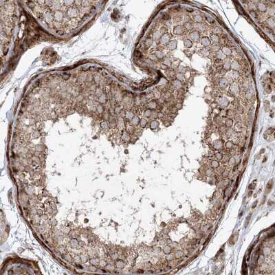 Immunohistochemistry-Paraffin: AARS2 Antibody [NBP1-89323] - Staining of human testis shows moderate to strong granular cytoplasmic positivity in cells in seminiferous ducts.