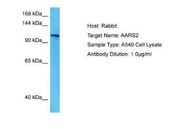 Western Blot: AARS2 Antibody [NBP2-86932] - Host: Rabbit. Target Name: AARS2. Sample Tissue: Human A549 Whole Cell lysates. Antibody Dilution: 1ug/ml