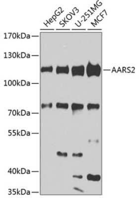 Western Blot: AARS2 Antibody [NBP2-92487] - Analysis of extracts of various cell lines, using AARS2 at 1:1000 dilution.Secondary antibody: HRP Goat Anti-Rabbit IgG (H+L) at 1:10000 dilution.Lysates/proteins: 25ug per lane.Blocking buffer: 3% nonfat dry milk in TBST.Detection: ECL Basic Kit .Exposure time: 20s.