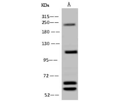 Western Blot AARS2 Antibody - BSA Free