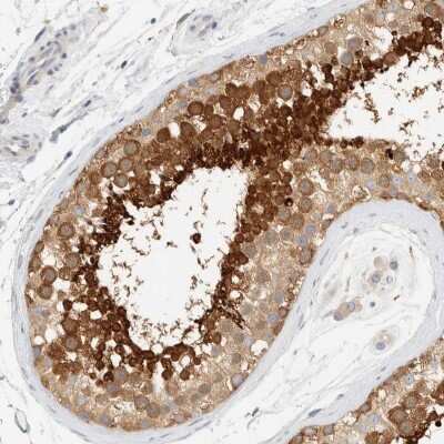 Immunohistochemistry-Paraffin AARSD1 Antibody