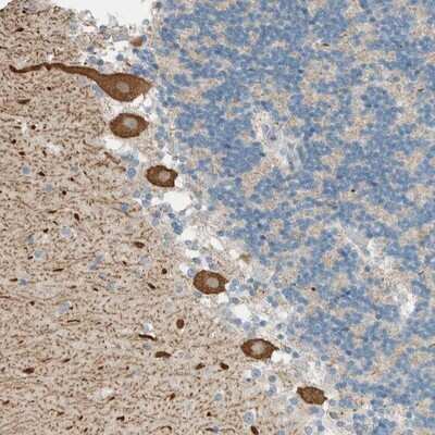 Immunohistochemistry-Paraffin: AARSD1 Antibody [NBP1-81145] - Staining of human cerebellum shows strong cytoplasmic positivity in Purkinje cells.