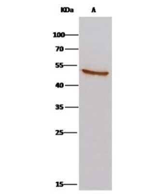 Immunoprecipitation: AARSD1 Antibody [NBP3-00270] - AARSD1 was immunoprecipitated using: Lane A: 0.5 mg Hela Whole Cell Lysate 2 ul anti-AARSD1 rabbit polyclonal antibody and 15 ul of 50 % Protein G agarose. Primary antibody: Anti-AARSD1 rabbit polyclonal antibody, at 1:100 dilution. Secondary antibody: Clean-Bloto IP Detection Reagent (HRP) at 1:1000 dilution. Developed using the DAB staining technique. Performed under reducing conditions. Predicted band size: 45 kDa. Observed band size: 45 kDa