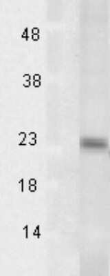 Western Blot AARSD1 Antibody (Tsp232A)