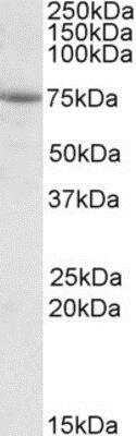 Western Blot: AARSD1 Antibody [NBP1-45215] - Analysis of AARSD1 in A549 lysate (35ug protein in RIPA buffer) at 1ug/ml. Primary incubation was 1 hour. Detected by chemiluminescence.