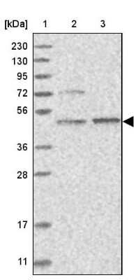 Western Blot AARSD1 Antibody