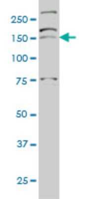 Western Blot: AATK/Serine/threonine-protein kinase LMTK1 Antibody (5B8) [H00009625-M03] - Analysis of AATK expression in Hela S3 NE (Cat # L013V3).