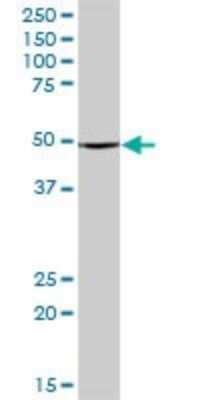 Western Blot: ABAT Antibody [H00000018-B01P] - Analysis of ABAT expression in human liver.