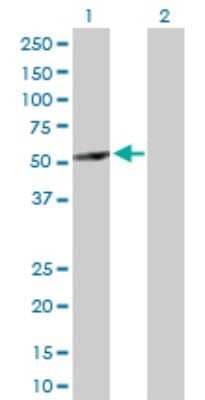 Western Blot: ABAT Antibody [H00000018-D01P] - Analysis of ABAT expression in transfected 293T cell line by ABAT polyclonal antibody.Lane 1: ABAT transfected lysate(56.40 KDa).Lane 2: Non-transfected lysate.