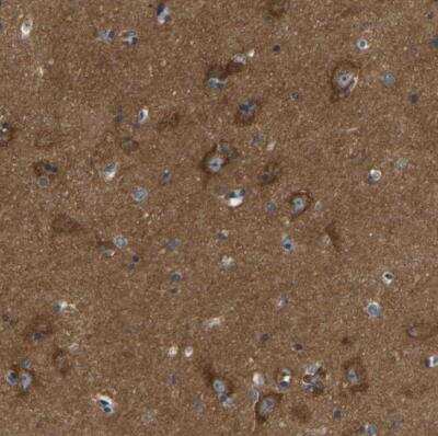 Immunohistochemistry-Paraffin ABCA10 Antibody - BSA Free