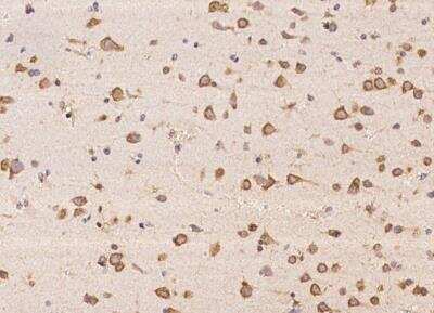 Immunohistochemistry-Paraffin ABCA10 Antibody - BSA Free