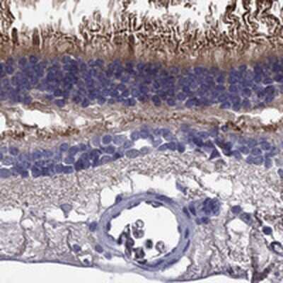 Immunohistochemistry-Paraffin: ABCA4 Antibody [NBP3-17333] - Staining of human retina shows strong cytoplasmic positivity in photoreceptor cells.