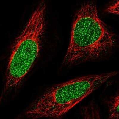 Immunocytochemistry/ Immunofluorescence ABCA5 Antibody - BSA Free