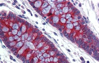 Immunohistochemistry-Paraffin: ABCA5 Antibody [NBP1-59809] - Human Colon Tissue, antibody concentration 5 ug/ml.