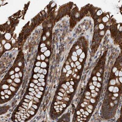 Immunohistochemistry-Paraffin: ABCA5 Antibody [NBP1-84780] - Staining of human colon shows strong cytoplasmic positivity in glandular cells.