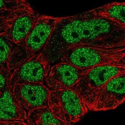 Immunocytochemistry/ Immunofluorescence ABCA6 Antibody - BSA Free