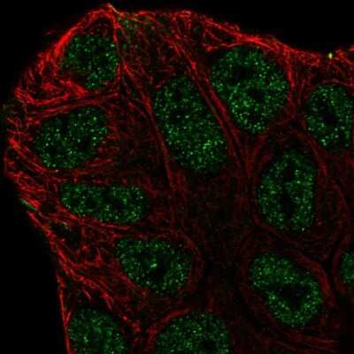 Immunocytochemistry/Immunofluorescence: ABCA6 Antibody [NBP2-57372] - Staining of human cell line RT4 shows localization to nucleoplasm.