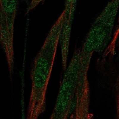 <b>Orthogonal Strategies Validation. </b>Immunocytochemistry/Immunofluorescence: ABCA8 Antibody [NBP1-91641] - Staining of human cell line ASC TERT1 shows localization to nucleoplasm & cytosol.