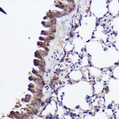Immunohistochemistry-Paraffin ABCA8A Antibody - Azide and BSA Free