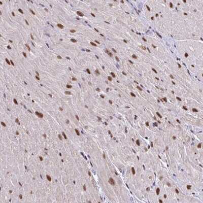 Immunohistochemistry-Paraffin: ABCA9 Antibody [NBP2-30843] - Staining of human heart muscle shows strong nuclear positivity in myocytes.