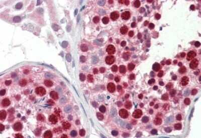 Immunohistochemistry-Paraffin: ABCA9 Antibody [NB100-93469] - Staining of paraffin embedded Human Testis with antibody at 5 ug/mL. Steamed antigen retrieval with citrate buffer pH 6, AP-staining.